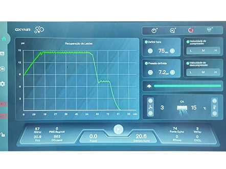 Real-Time Pressure Curve